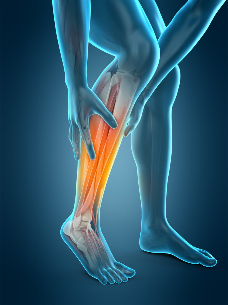 medically accurate 3d illustration of calf pain